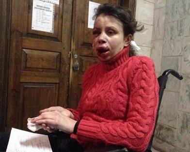 Journalisten Tetjana Tsjernovol ble mishandlet av voldsmenn i desember. Hun leder nå antikorrupsjonsetaten. (foto: Iryna Solomko)